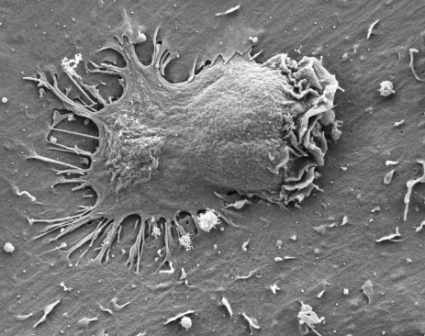 תצלום מיקרוסקופ אלקטרונים של תאים אפקטורים המחדירים רגליים דרך הקרום של תאי אנדותל